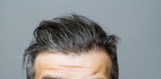 Przeszczep włosów - ogólne informacje